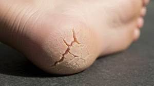 Podologia na Bahia: Guia Completo da All Pé Salvador