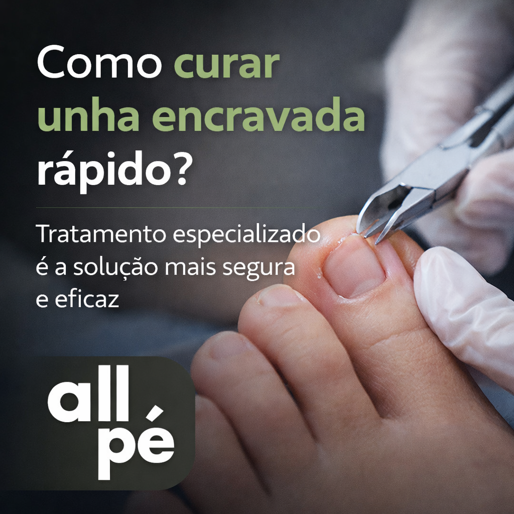 Como curar unha encravada rápido tratamento especializado é a solução mais segura e eficaz - AllPe