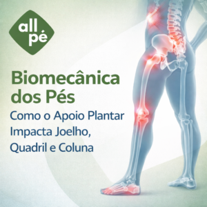 Biomecânica dos Pés Como o apoio plantar impacta joelho, quadril e coluna - All Pe