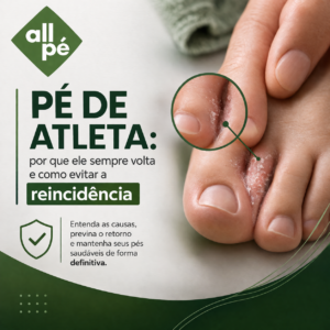 Pé de atleta por que ele sempre volta e como evitar a reincidência